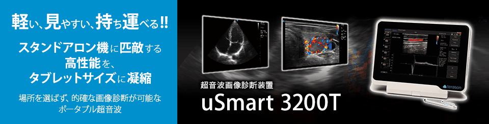 超音波画像診断装置 uSmart 3200T