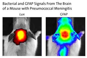 Bacterial and GFAP Signals From The Brain of a Mouse with Pneumococcal Meningitis