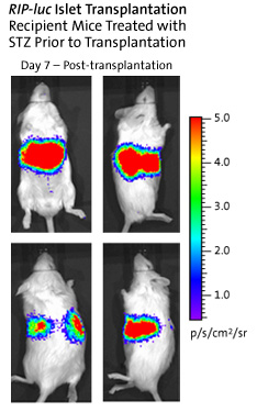RIP-luc Islet Transplantation Recipient Mice Treated with STZ Prior to Transplantation