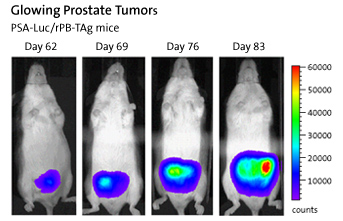 Glowing Prostate Tumors: PSA-luc/rPB-TAg mice