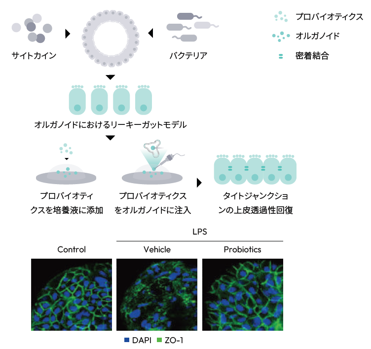 リーキーガット症候群モデル