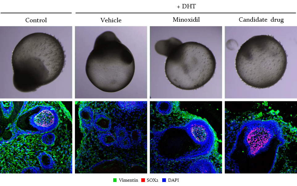 評価例. 脱毛予防効果の検証
