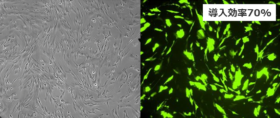 B）Bronchial Tracheal Smooth Muscle Cells（PCS 130-011™）