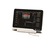 超音波画像診断装置 uSmart 3200T