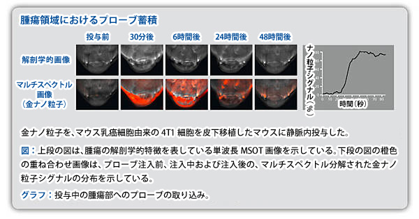 腫瘍領域におけるプローブ蓄積