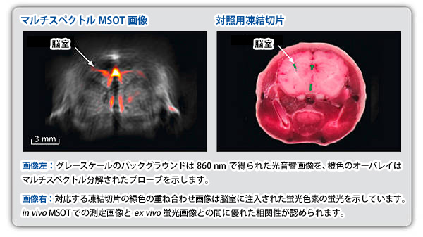 分子プローブ