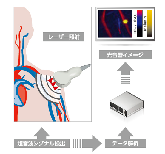 MSOTの技術