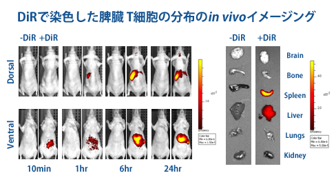 担癌部位への集積性