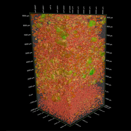 3D画像：アメリカンドッグの解析（気泡膜厚）