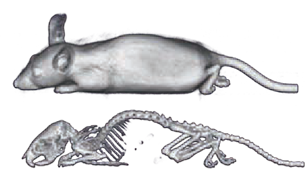 ホールボディスキャン