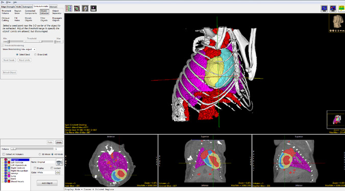 図14. Analyze 14のセグメントモジュールに含まれる、組織や領域の迅速かつ正確な定義のための高度なインタラクティブツール