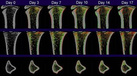骨代謝の経時観察
