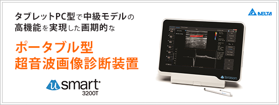 超音波画像診断装置 uSmart 3200T